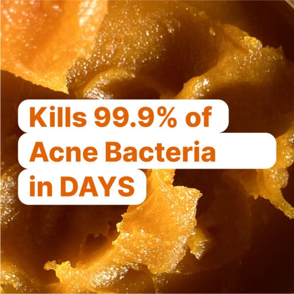 Kill Acne & Redness Ritual - Image 8